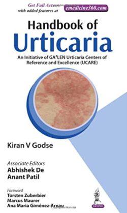 Handbook of Urticaria An Initiative of GA2LEN Urticaria Centers of Reference and Excellence (UCARE)