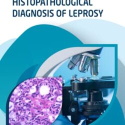 Diagnosi istopatologica della lebbra
