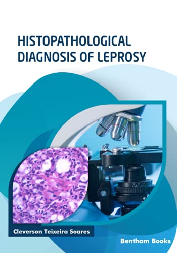 Histopathologische diagnose van lepra
