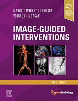 Image-Guided Interventions Third Edition (3rd ed/3e)