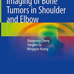 Imaging of Bone Tumors in Shoulder and Elbow 1st ed. 2021 Edition