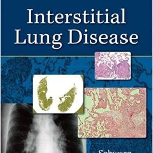 Interstitial Lung Disease, Fifth Edition (5th ed/5e)
