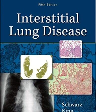Interstitial Lung Disease, Fifth Edition