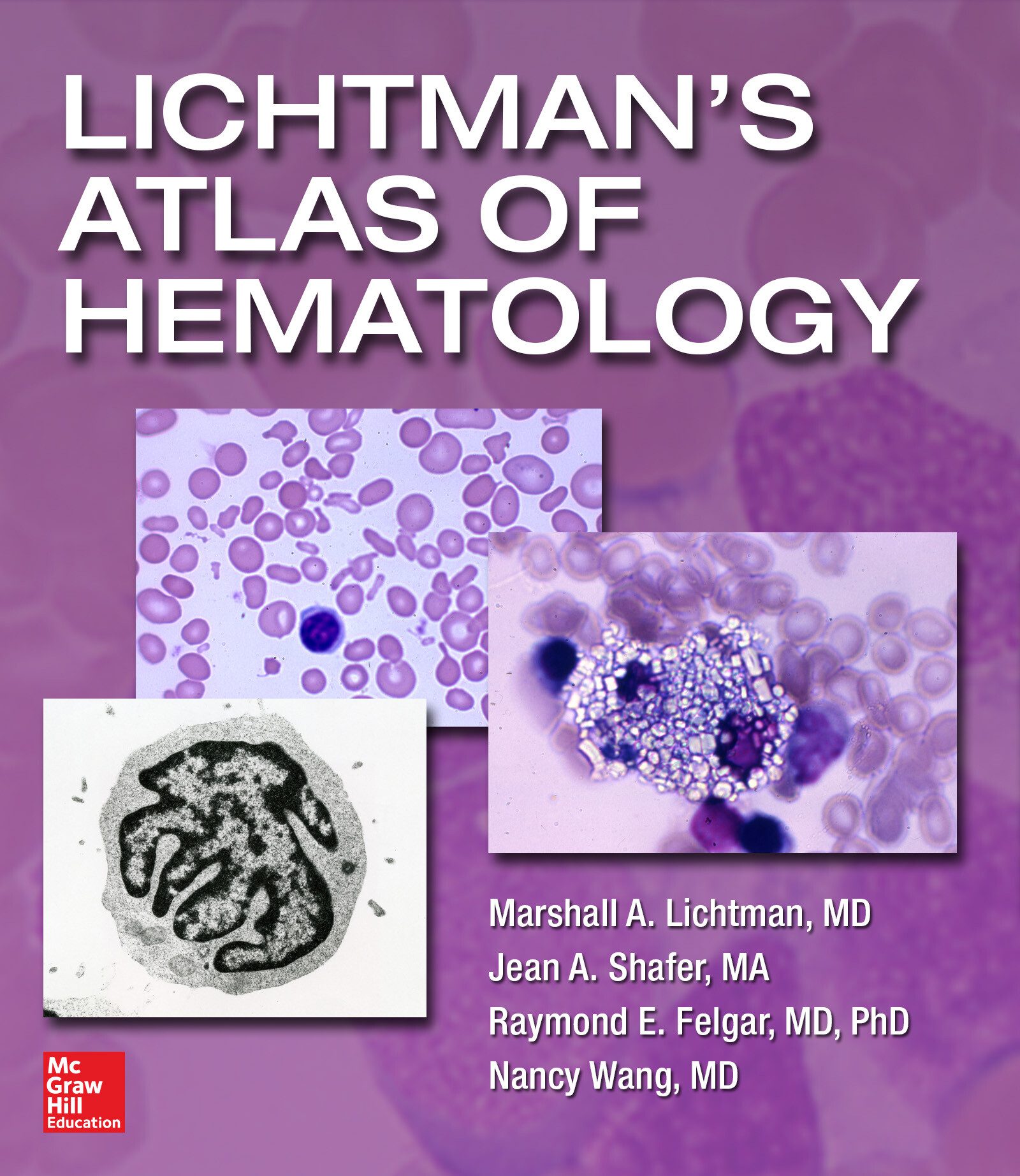 Atlas de Hematología de Lichtman 2016 (Lichtmans)
