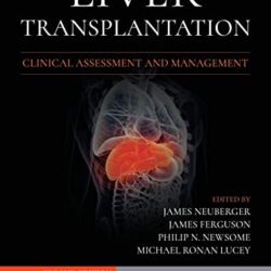 Manejo y evaluación clínica del trasplante de hígado Segunda edición (2nd ed/2e)