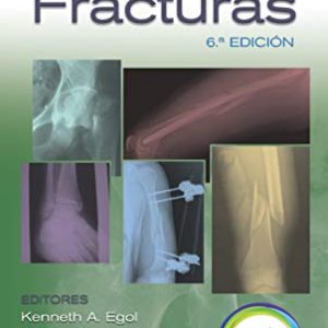 Manual de fracturas (Spanish Edition) 6th Edition