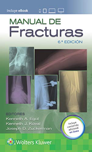 Manual de fracturas (spanische Ausgabe) 6. Auflage