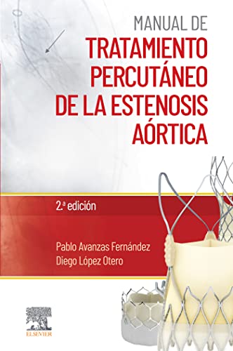 Manual de tratamiento percutaneo de la estenosis aortica Spanish Edition Edicion