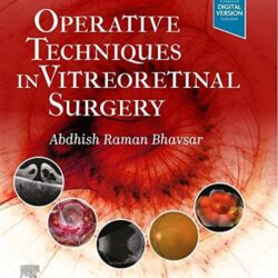 Operative Techniques in Vitreoretinal Surgery 1st Edition First ed 1e