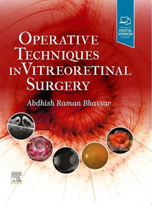 Operative Techniques in Vitreoretinal Surgery 1st Edition First ed 1e