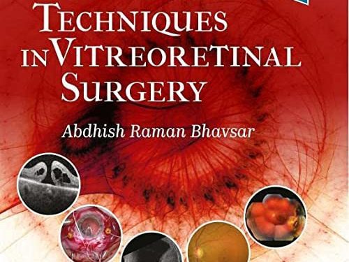 Operative Techniques in Vitreoretinal Surgery 1st Edition by Abdhish Bhavsar MD (Editor)