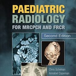 Paediatric Radiology for MRCPCH and FRCR, Second Edition 2nd Edition by Chris Schelvan (Author), Annabel Copeman (Author), Jacky Davis (Author), Annmarie Jeanes (Author), Jane Young (Author)