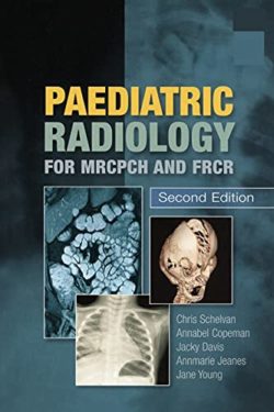 Paediatric Radiology for MRCPCH and FRCR, 2nd Edition ( Second Ed 2e)