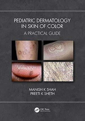 Pediatric Dermatology in Skin of Color A Practical Guide First Edition (1st ed/1e)