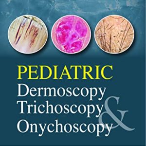 Pediatric Dermoscopy, Trichoscopy and Onychoscopy 1st Edition