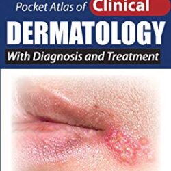 Pocket Atlas of Clinical Dermatology