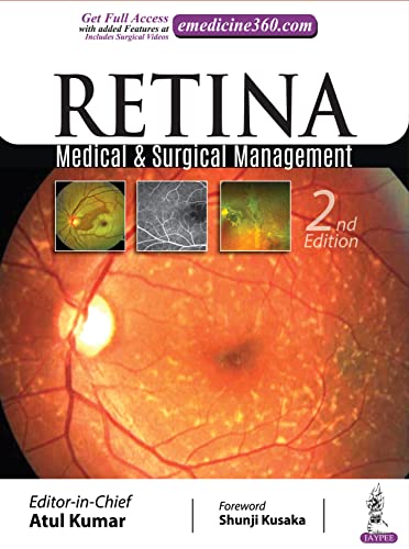 Retina: Manejo Médico y Quirúrgico 2da Edición (Segunda ed/2e)
