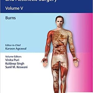 Textbook of Plastic, Reconstructive, and Aesthetic Surgery Volume 5-Burns (Vol Five/v)