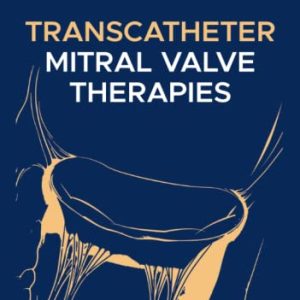 Transcatheter Mitral Valve Therapies First Edition 1e