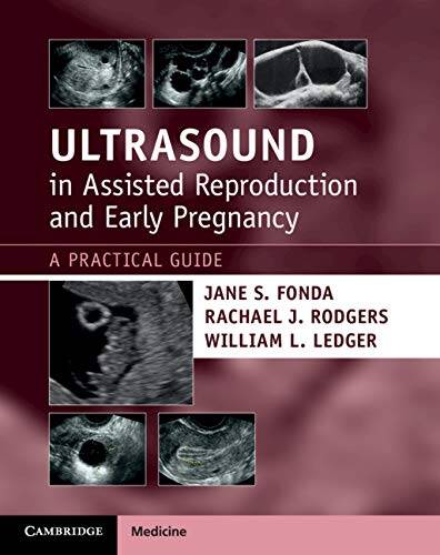 Ecografia en reproducció assistida i embaràs precoç Una guia pràctica Primera edició (1a ed/1e)