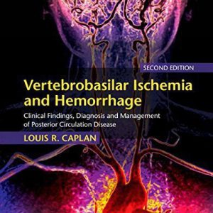 Vertebrobasilar Ischemia and Hemorrhage Clinical Findings, Diagnosis and Management of Posterior Circulation Disease 2nd Edition