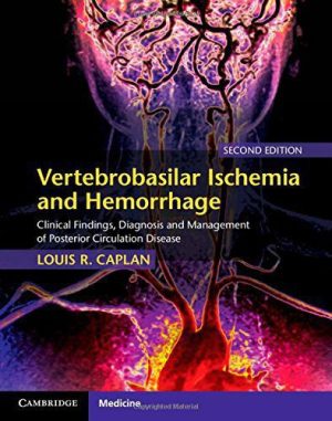 Vertebrobasilar Ischemia and Hemorrhage Clinical Findings, Diagnosis and Management of Posterior Circulation Disease 2nd Edition