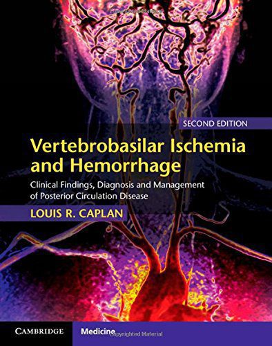 Vertebrobasilar Ischemia and Hemorrhage Clinical Findings Diagnosis and Management of Posterior Circulation Disease 2nd Edition