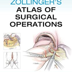 Atlas de operaciones quirúrgicas de Zollinger, undécima edición (Zollingers 11th Ed/11e)