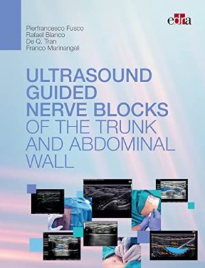 Ultrasound-guided nerve blocks of the trunk and & abdominal wall