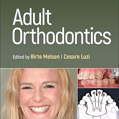 Adult Orthodontics 2nd Edition