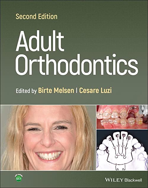Orthodontie adulte 2e édition