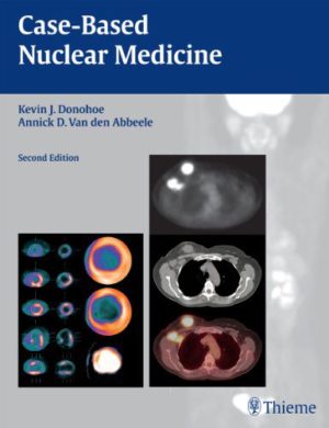 Case-Based Nuclear Medicine 2nd Edition Second ed 2e
