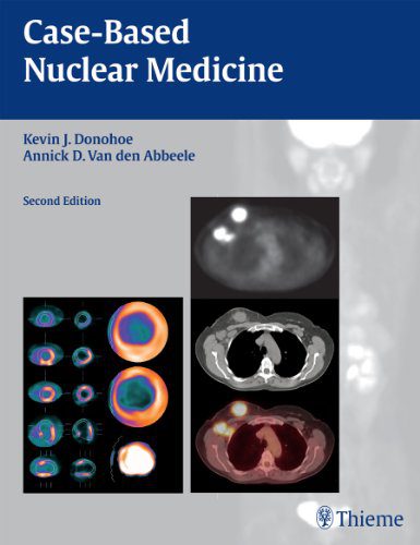 Ядерная медицина на основе конкретного случая, 2-е издание, второе изд. 2e