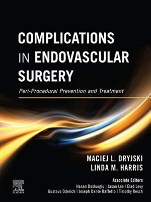 Complications in Endovascular Surgery: Peri-Procedural Prevention and Treatment 1st Edition