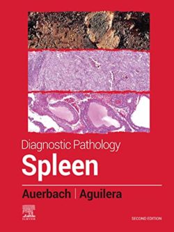 Diagnostic Pathology: Spleen Second Edition