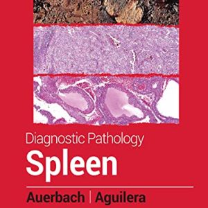 Diagnostic Pathology: Spleen 2nd Edition