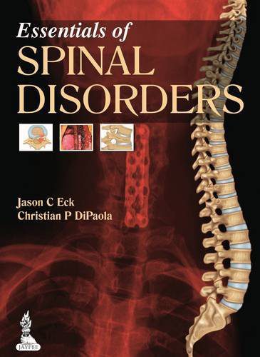 Essentials of Spinal Disorders 1st Edition
