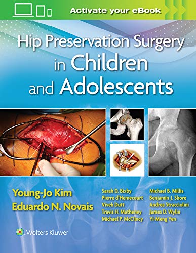 Pembedahan Pemeliharaan Pinggul pada Kanak-kanak dan Remaja Edisi Pertama