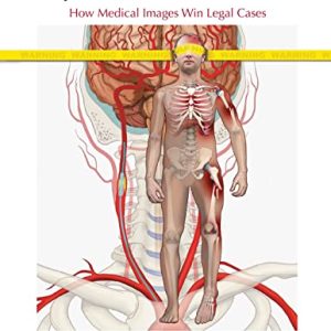 Injury Illustrated: How Medical Images Win Legal Cases 1st Edition