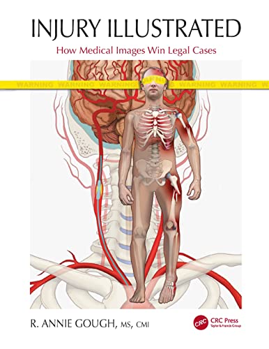 Injury Illustrated: Как медицинские изображения выигрывают судебные дела, 1-е издание