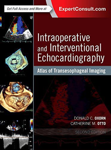 PDF Sample Intraoperative and Interventional Echocardiography: Atlas of Transesophageal Imaging 2nd Edition
