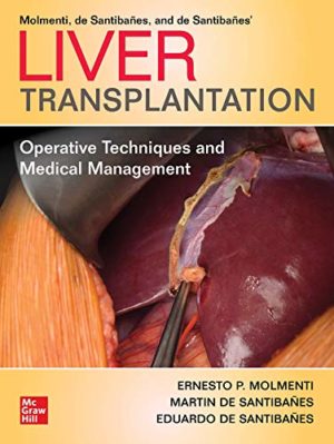 Liver Transplantation: Operative Techniques and Medical Management 1st Edition