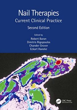 Nail Therapies: Current Clinical Practice 2nd Edition Second ed 2e