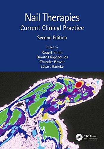 Nail Therapies: Current Clinical Practice 2nd Edition מהדורה 2e