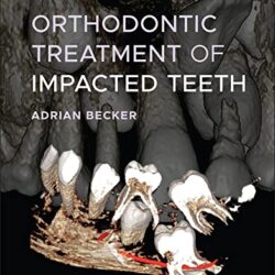 Tratamiento de ortodoncia de dientes impactados 4ª edición Cuarta ed 4e