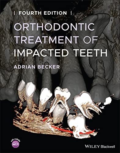 Orthodontic Treatment of Impacted Teeth 4th Edition Fourth ed 4e