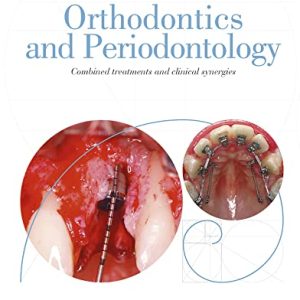 Orthodontics and Periodontology: Combined treatments and clinical synergies