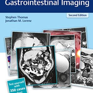 RadCases Plus Q&A Gastrointestinal Imaging 2nd Edition