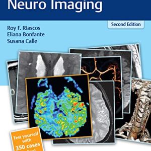 RadCases Plus Q&A Neuro Imaging 2nd Edition Second ed 2e