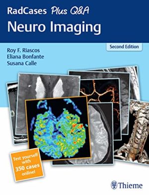 RadCases Plus Q&A Neuro Imaging 2nd Edition Second ed 2e